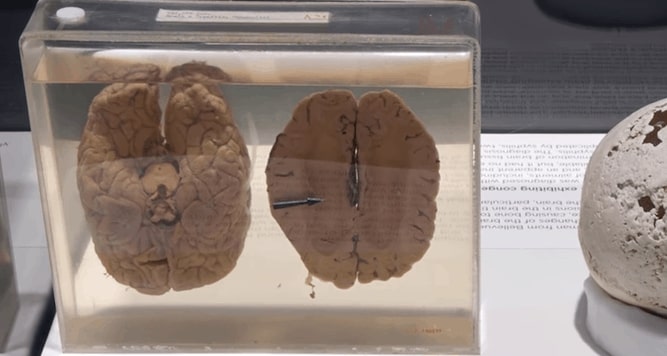 The Strange Story of Albert Einstein’s Brain After Death & The Key Findings