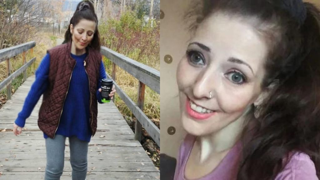 Full Story of Kelly Ronahan: Munchausen's or a Misdiagnosis