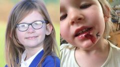 Olivia Farnsworth: Bionic Girl Who Can’t Feel Pain, Hunger, Fatigue