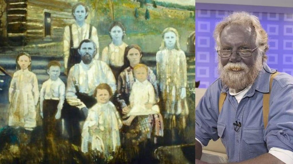 Who are Blue People of Kentucky? Fugate Family’s Blue Skin Mystery Unraveled Blue People of Kentucky: Fugate Family's Blue Skin Mystery Unraveled