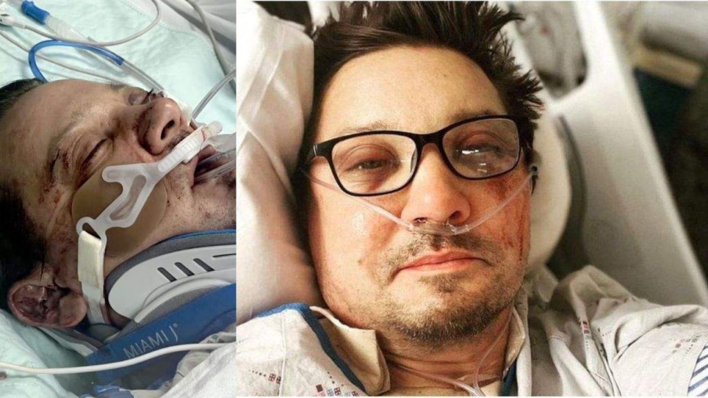 Why #RIPJeremyRenner is Trending? Did Jeremy Renner Passed Away? Why #RIPJeremyRenner is Trending? Did Jeremy Renner Passed Away?